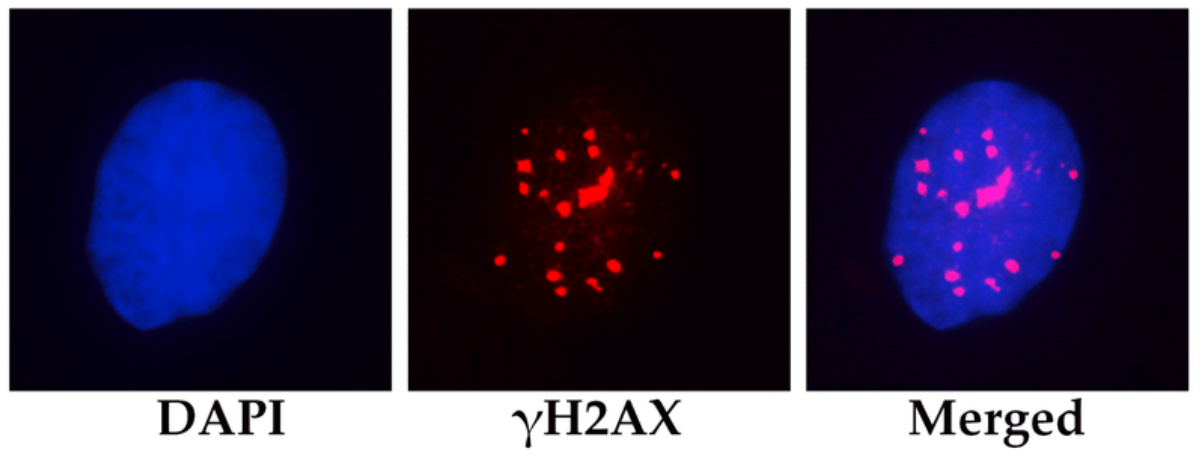 Микрофотография ядра мезенхимальной стволовой клетки человека. Слева направо: ДНК клеточного ядра, окрашенное DAPI (синий); скопления (фокусы ) белка γH2AX (красные точки), маркирующего повреждения ДНК; наложенные микроизображения (merged)