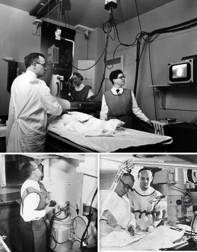 Вверху: кардиолог Фрэнк Мейсон Соунс-младший (1918-1985) в своей рентгенлаборатории проводит коронарографию. Подвал Кливлендской клиники, 1960-е годы, исследовательский этап истории коронарографии. Медики в защитных свинцовых фартуках, но без шапочек и масок, обязательных при современной рентгенэндоваскулярной диагностике. Внизу слева: Соунс в детекторной яме под столом, на котором было сделано его главное открытие. Чёрной стрелкой показана кинокамера. Внизу справа: Соунс вводит контраст через плечевую артерию. Интервенционные кардиологи поначалу делились на два непримиримых лагеря – те, кто за плечевой доступ по Соунсу, и большинство, придерживавшееся бедренного доступа по Джадкинсу. При этом личные отношения между Соунсом и Джадкинсом были самые приятельские.
