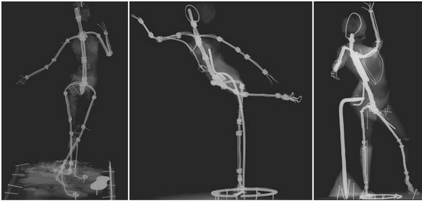 Рентгеновские снимки (слева направо) «Изогнувшейся танцовщицы», «Арабеска на правой ноге с вытянутой левой рукой» и «Танцовщицы с бубном»