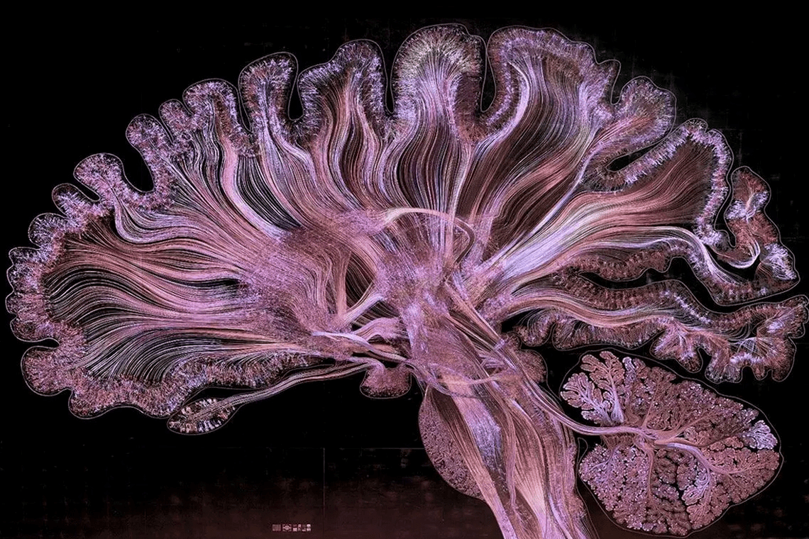 Изображение человеческого мозга, полученное при помощи электрического микротравления под фиолетовым и белым светом