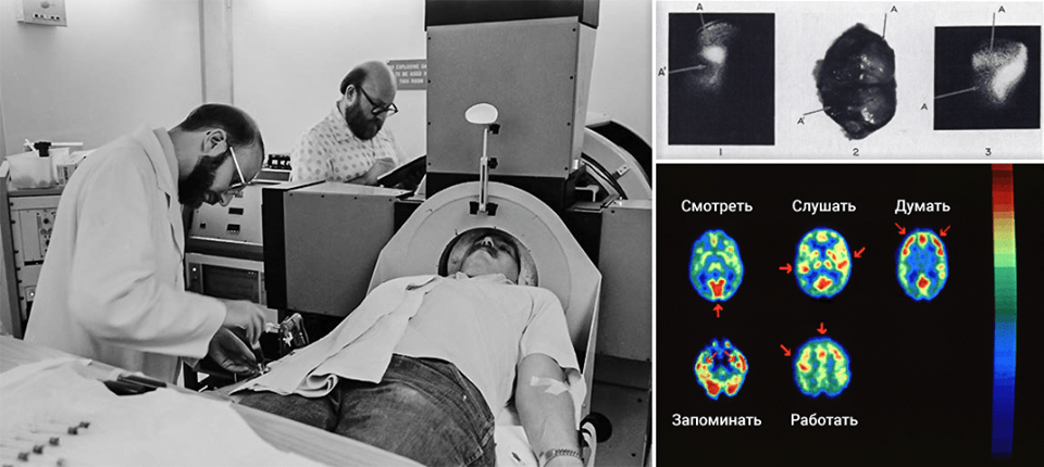 Первые медицинские эксперименты с позитронно-эмиссионной томографией Слева: лежащий в томографе доброволец получает инъекцию 18F-ФДГ Справа вверху: первые снимки первой опухоли, выявленной Прантикой Сом с помощью ПЭТ, 1980 Справа внизу: первая полученная при помощи ПЭТ визуализация работы мозга при выполнении добровольцами разных команд, 1982.