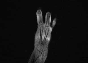 Изображение ладони, полученное с помощью прототипа МРТ-перчатки, во время игры на пианино Bei Zhang et al./ Nature Biomedical Engineering, 2018